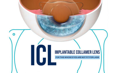 Best ICL Surgery in Patiala