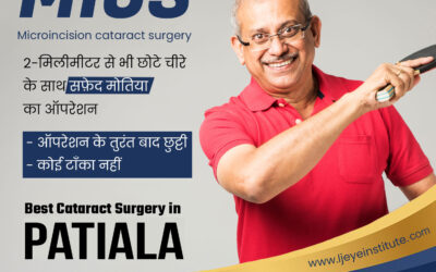 Best Cataract Surgery in Patiala