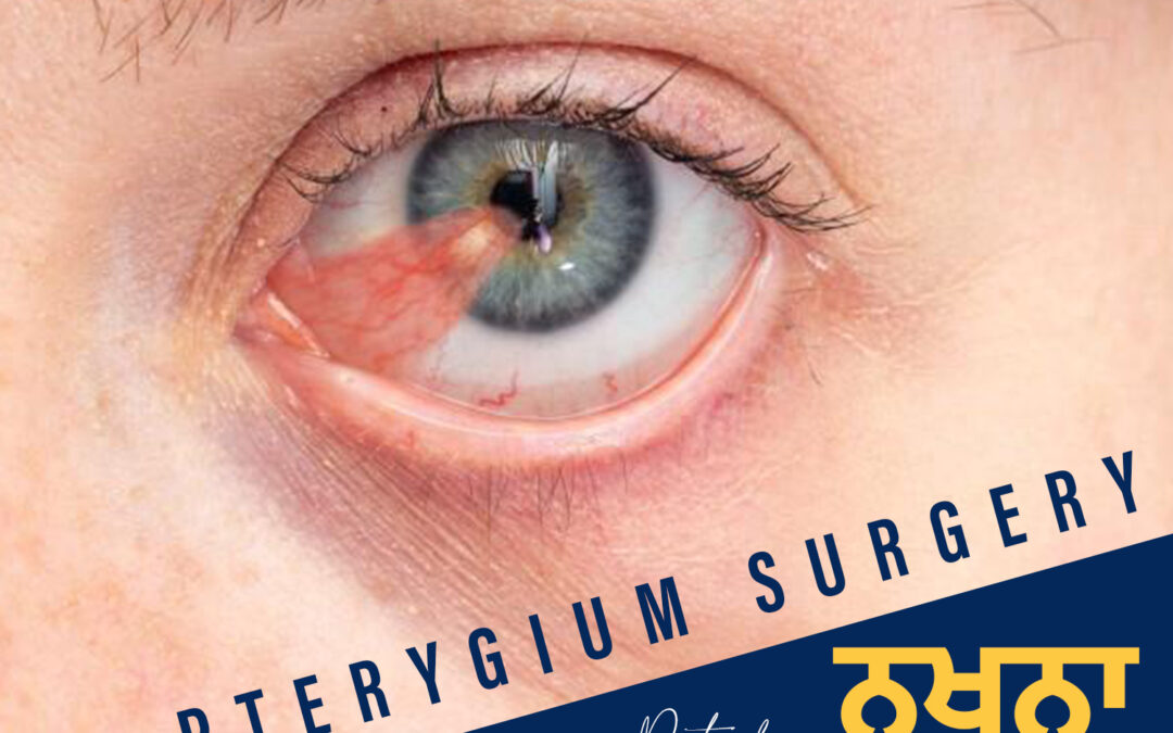 Pterygium: Causes, Symptoms & When to See an Eye Specialist